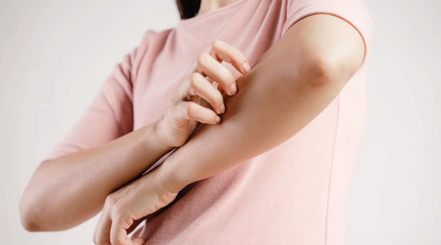 Concept of discomfort and irritation caused by bedbug bites